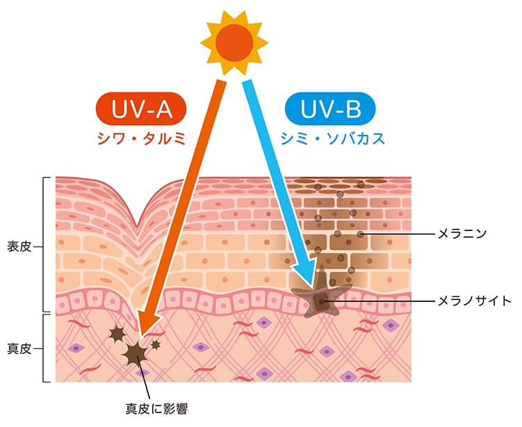 日焼けの正体と仕組み