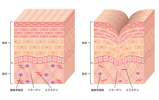 しわやたるみが深くなる