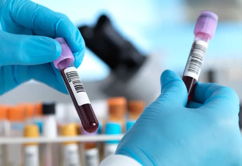 糖尿病の種類とそれぞれの特徴