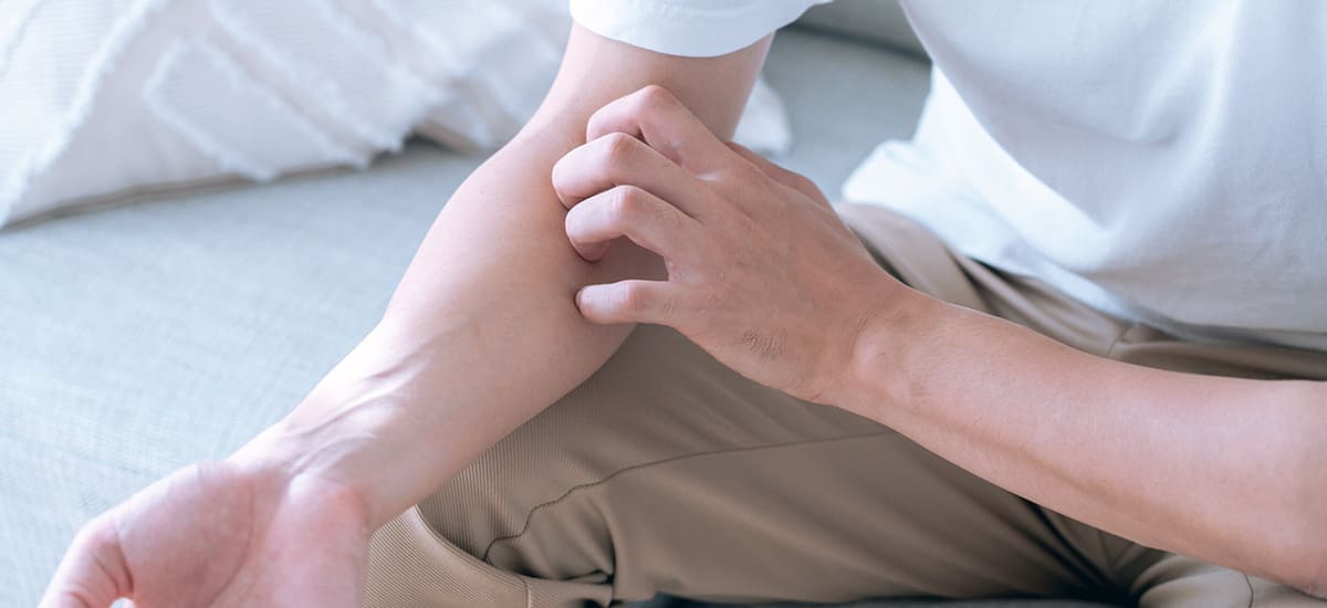 皮膚が乾燥してかゆい