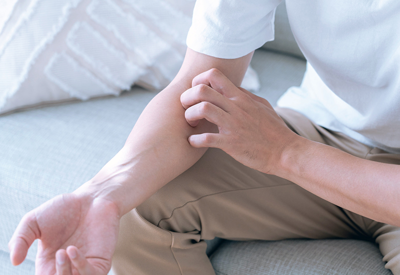 皮膚が乾燥してかゆい