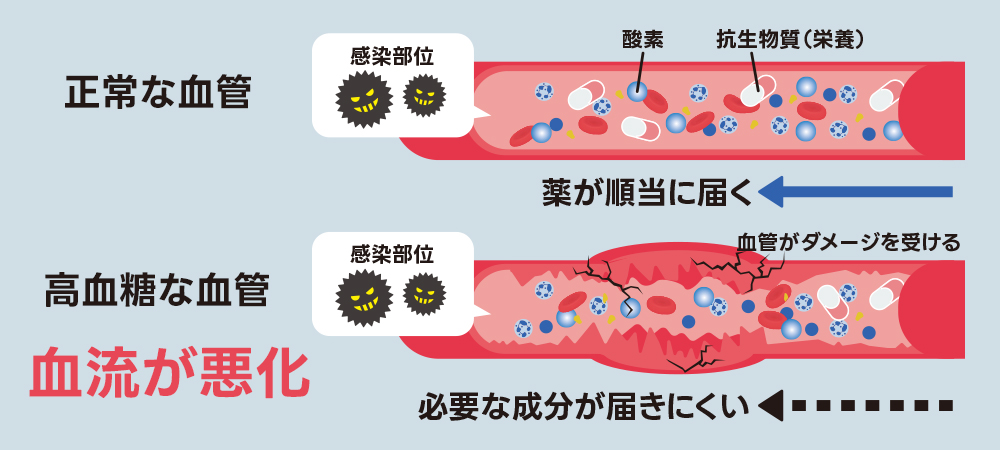 血流が悪く、薬が患部に届かない