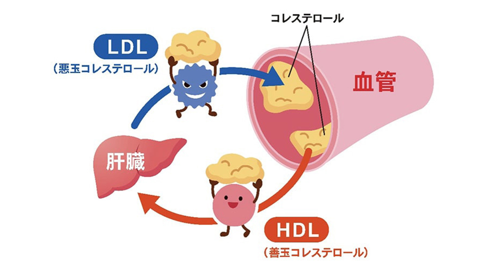 脂質異常症の管理